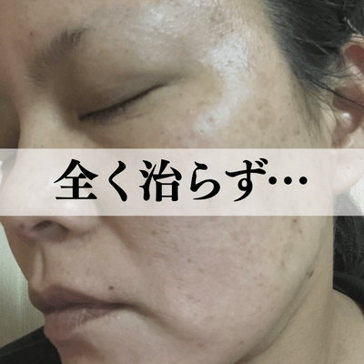 全く治らず...