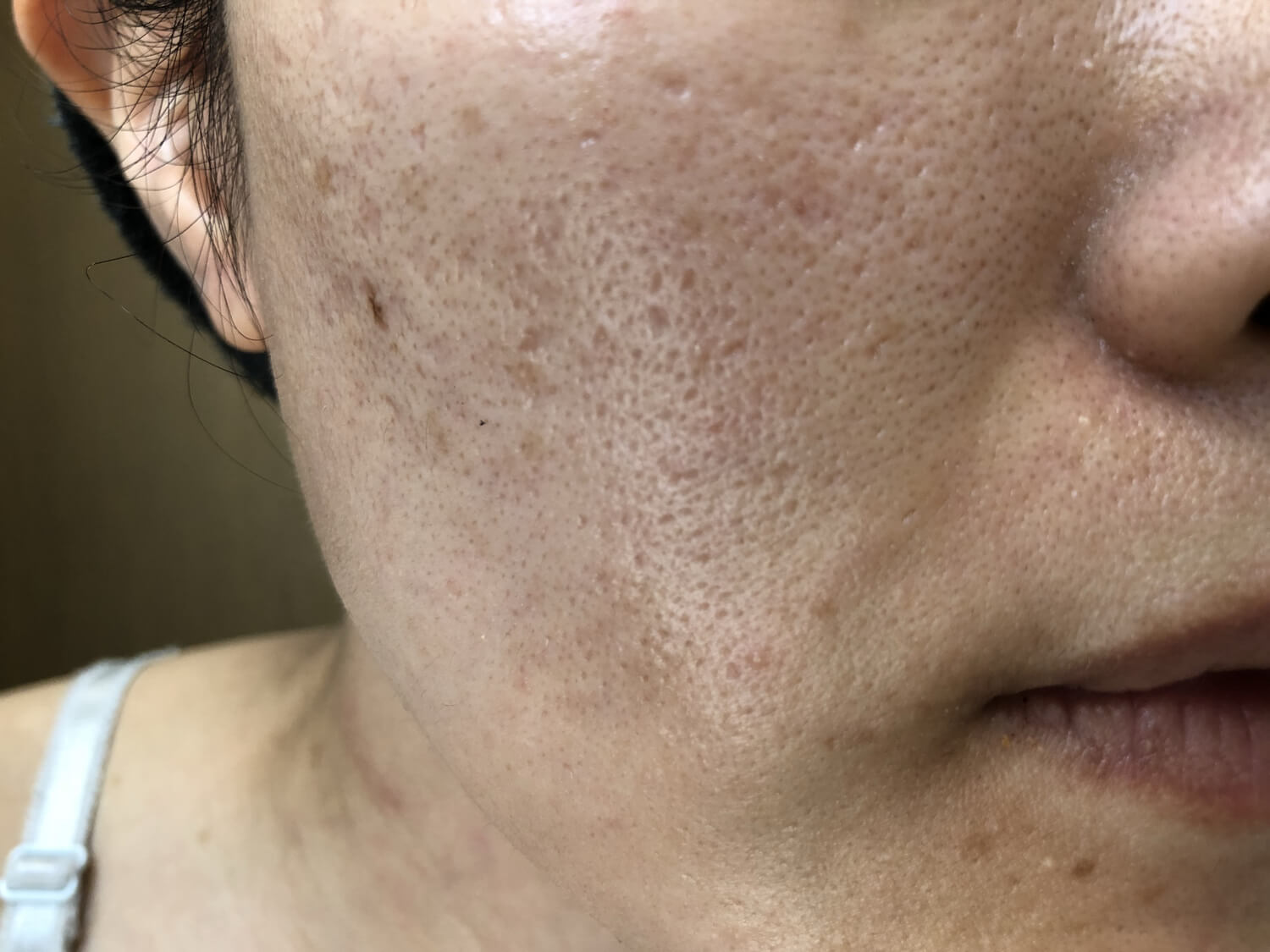 ケアを放置した肌